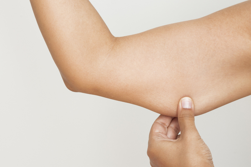 How To Tighten Loose Skin on Arms Naturally